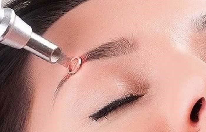 ریمو تاتو قدیمی