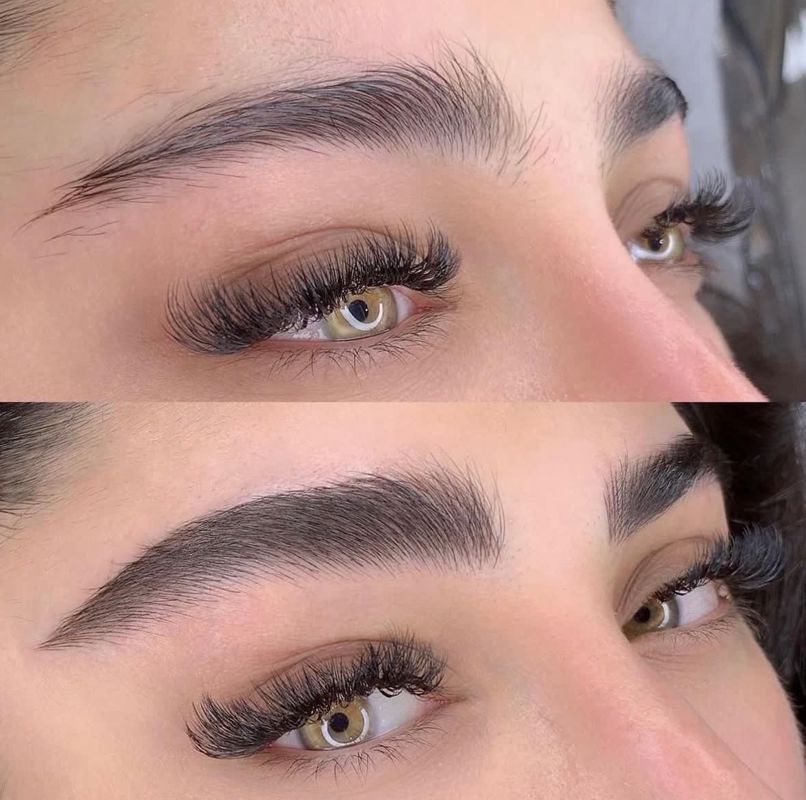 فیبروز کرکی مویی