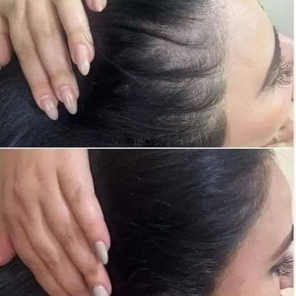 اسکالپ سر